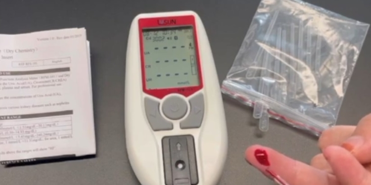 RFM 101 Renal Function Analysis Meter